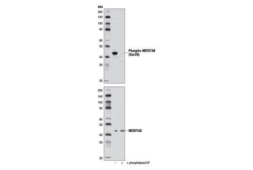 Western Blotting Image 1: Phospho-MERIT40 (Ser29) Antibody