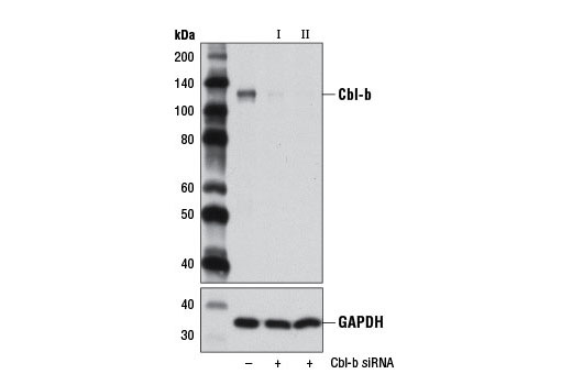  Image 1: SignalSilence® Cbl-b siRNA II