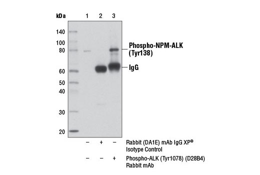 Immunoprecipitation Image 1: Phospho-ALK (Tyr1078) (D28B4) Rabbit mAb