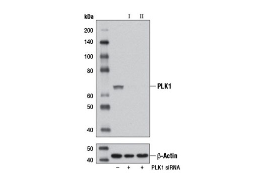  Image 1: SignalSilence® PLK1 siRNA II