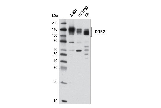 Western Blotting Image 1: DDR2 Antibody