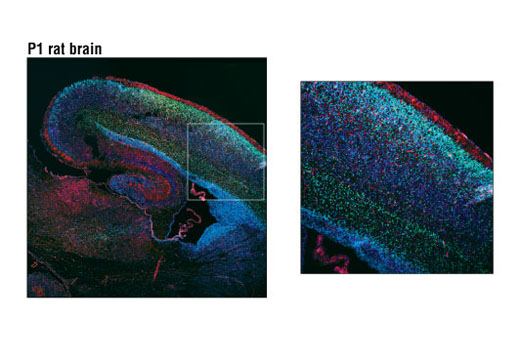 Immunofluorescence Image 1: Brn2/POU3F2 (D2C1L) Rabbit mAb