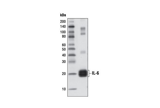  Image 2: Senescence Associated Secretory Phenotype (SASP) Antibody Sampler Kit