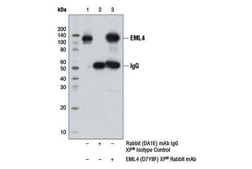 Immunoprecipitation Image 1: EML4 (D7Y8F) XP® Rabbit mAb
