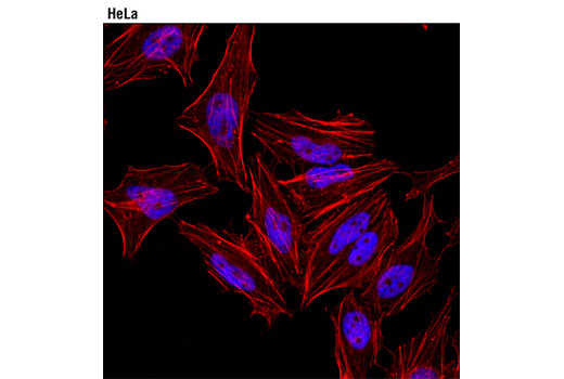 Immunofluorescence Image 1: Tri-Methyl-Histone H3 (Lys27) (C36B11) Rabbit mAb (Alexa Fluor® 647 Conjugate)