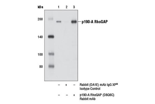 Immunoprecipitation Image 1: p190-A RhoGAP (D8Q6C) Rabbit mAb