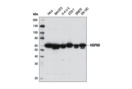 Image 1: HSP/Chaperone Antibody Sampler Kit