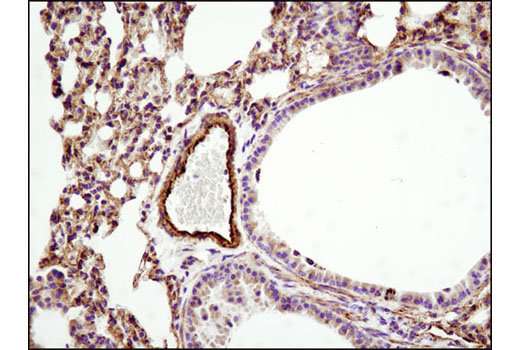  Image 13: Mitochondrial Marker Antibody Sampler Kit