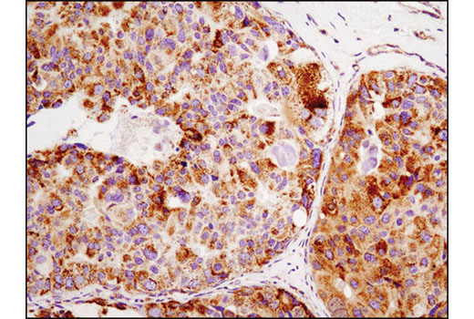  Image 19: Mitochondrial Marker Antibody Sampler Kit
