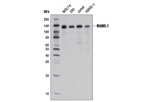  Image 2: Notch Activated Targets Antibody Sampler Kit