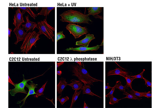 Immunofluorescence Image 1: Phospho-HSP27 (Ser82) (D1H2F6) XP® Rabbit mAb (Alexa Fluor® 488 Conjugate)