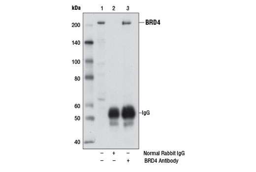Immunoprecipitation Image 1: BRD4 Antibody