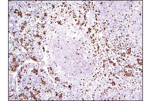 Immunohistochemistry Image 3: Ki-67 (D3B5) Rabbit mAb (Mouse Preferred; IHC Formulated)