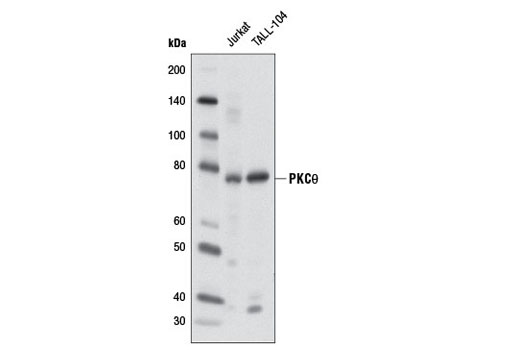 Western Blotting Image 1: PKCθ (P632) Antibody