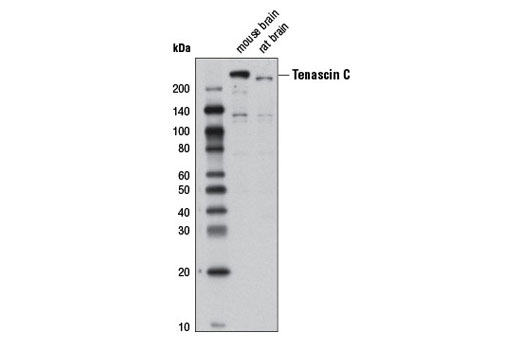 Western Blotting Image 1: Tenascin C (D16C4) Rabbit mAb