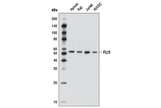 Western Blotting Image 1: FLI1 Antibody