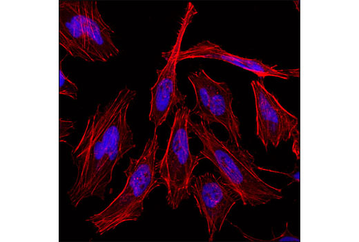 Immunofluorescence Image 1: Histone H3 (D1H2) XP® Rabbit mAb (Alexa Fluor® 647 Conjugate)