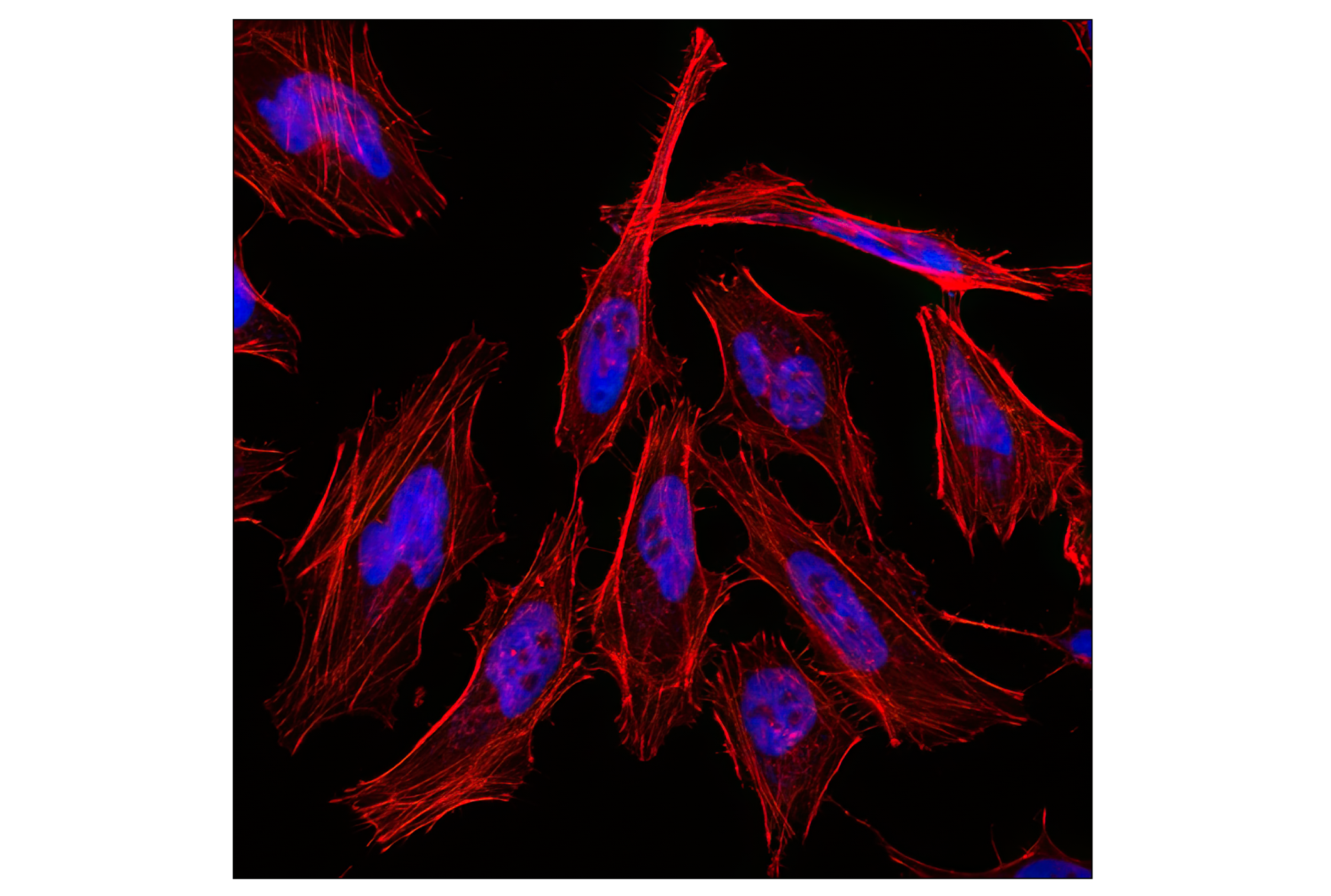 Immunofluorescence Image 1: Histone H3 (D1H2) XP® Rabbit mAb (Alexa Fluor® 647 Conjugate)