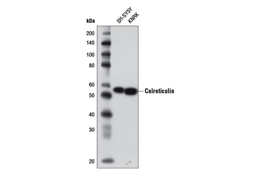 Western Blotting Image 1: Calreticulin (D3E6) XP® Rabbit mAb