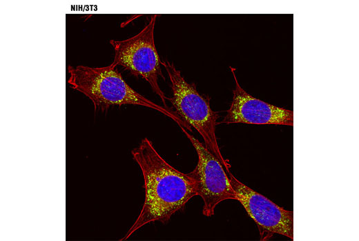 Immunofluorescence Image 1: Calreticulin (D3E6) XP® Rabbit mAb