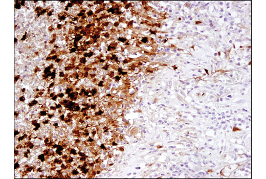 Immunohistochemistry Image 2: IL-1β (3A6) Mouse mAb