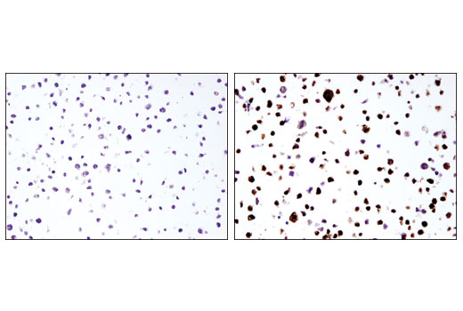 Immunohistochemistry Image 3: IL-1β (3A6) Mouse mAb
