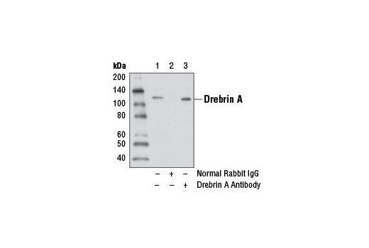 Immunoprecipitation Image 1: Drebrin A Antibody