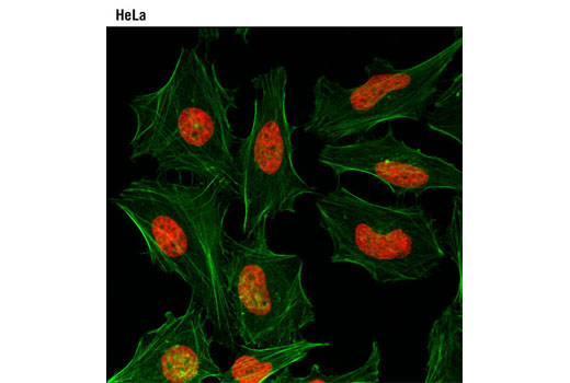Immunofluorescence Image 1: Di-Methyl-Histone H3 (Lys27) (D18C8) XP® Rabbit mAb (Alexa Fluor® 647 Conjugate)