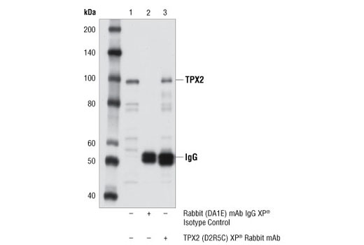 Immunoprecipitation Image 1: TPX2 (D2R5C) XP® Rabbit mAb
