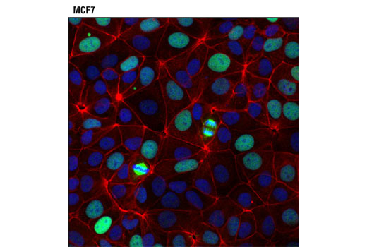 Immunofluorescence Image 1: TPX2 (D2R5C) XP® Rabbit mAb