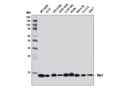  Image 3: Ubiquitin E3 Ligase Complex Antibody Sampler Kit
