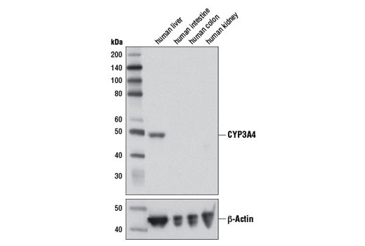 Western Blotting Image 1: CYP3A4 Antibody
