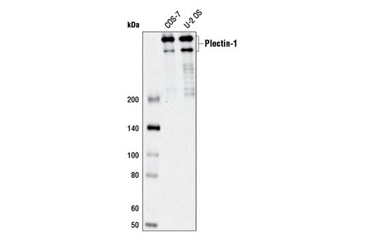 Western Blotting Image 1: Plectin-1 (D6A11) Rabbit mAb