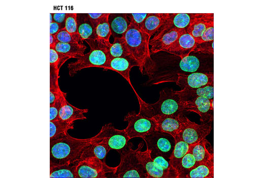 Immunofluorescence Image 1: Lamin B2 (D8P3U) Rabbit mAb