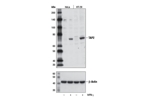 Western Blotting Image 1: TAP2 Antibody