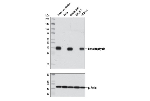 Western Blotting Image 1: Synaptophysin (7H12) Mouse mAb