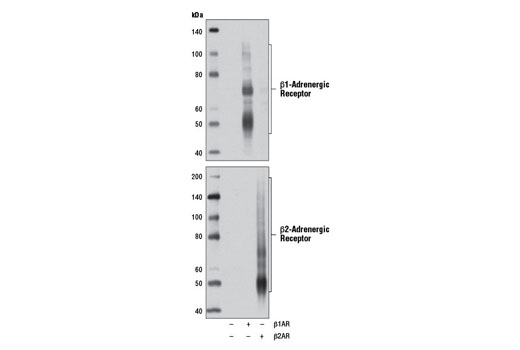 Western Blotting Image 2: β1-Adrenergic Receptor Antibody 