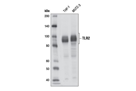  Image 1: Toll-like Receptor Antibody Sampler Kit