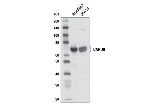 Western Blotting Image 1: CARD9 Antibody (Mouse Preferred)