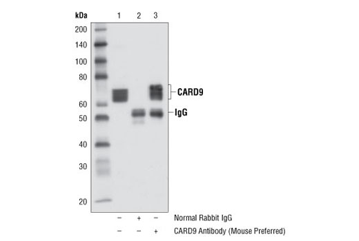 Immunoprecipitation Image 1: CARD9 Antibody (Mouse Preferred)