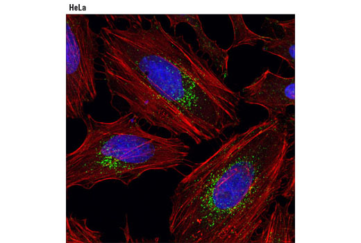 Immunofluorescence Image 1: LAMTOR4/C7orf59 (D6A4V) Rabbit mAb