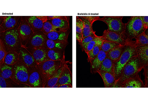 Immunofluorescence Image 1: RCAS1 (D2B6N) XP® Rabbit mAb