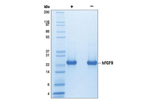  Image 2: Human Fibroblast Growth Factor 9 (hFGF9)
