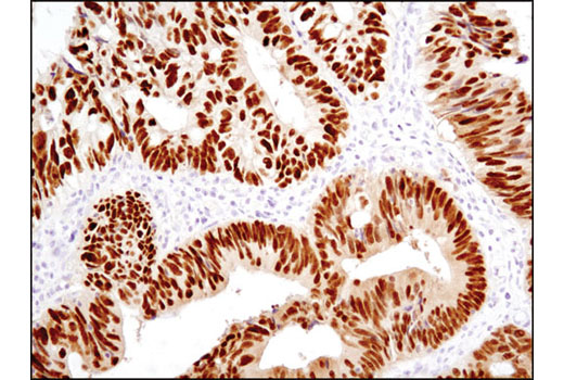 Immunohistochemistry Image 1: CDX2 (D11D10) Rabbit mAb