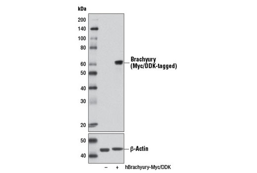 Western Blotting Image 1: Brachyury Antibody