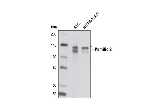 Western Blotting Image 1: Pumilio 2 Antibody