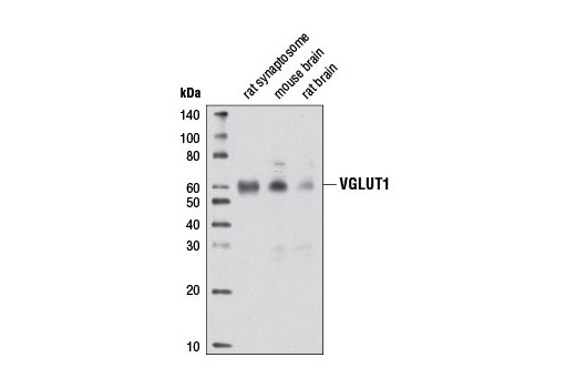 Western Blotting Image 1: VGLUT1 Antibody