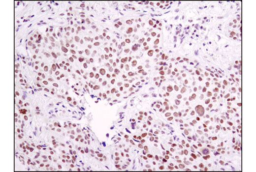 Immunohistochemistry Image 1: ERCC1 (D6G6) XP® Rabbit mAb
