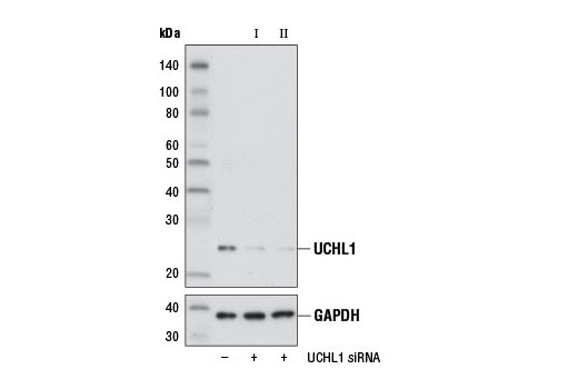  Image 1: SignalSilence® UCHL1 siRNA I