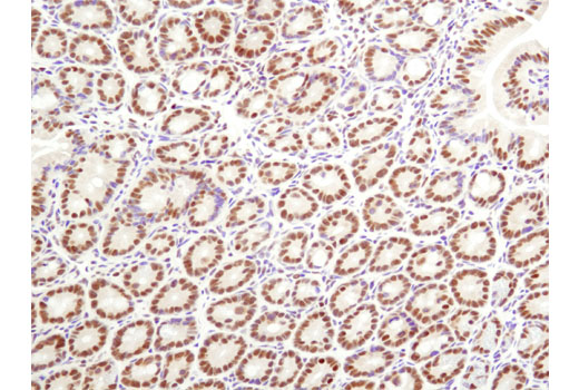 Immunohistochemistry Image 1: ARID1A/BAF250A (D2A8U) Rabbit mAb